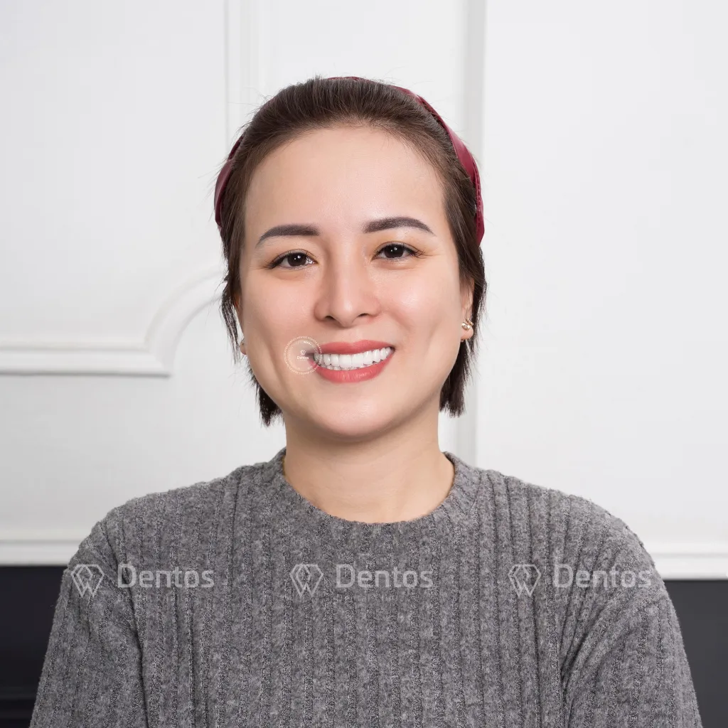 Giá bọc răng sứ sẽ tỷ lệ thuận với số lượng răng bạn cần làm